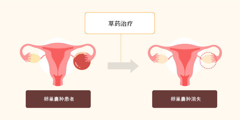 통계